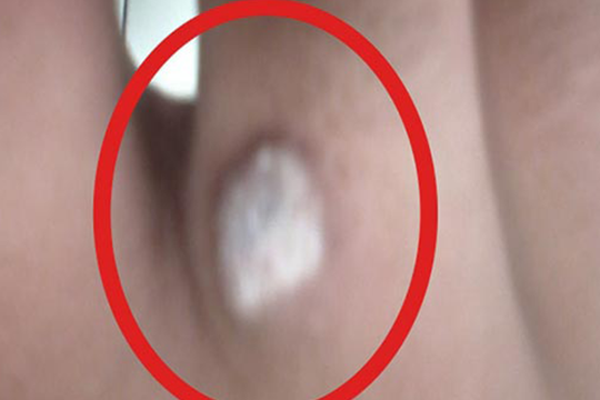 before-img